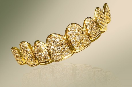gold tooth gems